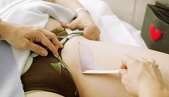 Epilation du maillot à la cire